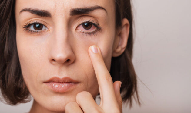 आई फ्लू यानी कंजक्टिवाइटिस के लक्षण एवं बचाव.